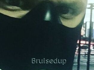 Bruisedup